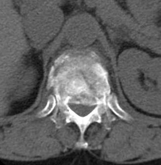 1670566729259393.png CT2.png