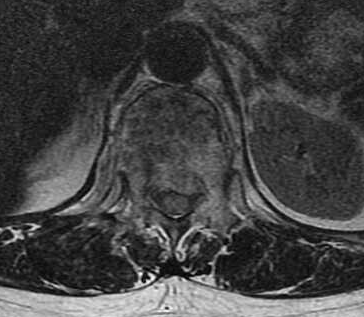 1670566753870157.png MRI2.png